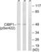C-Terminal Binding Protein 1 antibody, LS-C198853, Lifespan Biosciences, Western Blot image 