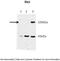 Ras and Rab interactor-like protein antibody, A14918, Boster Biological Technology, Western Blot image 
