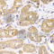 Ribosomal Protein S4 X-Linked antibody, A6730, ABclonal Technology, Immunohistochemistry paraffin image 