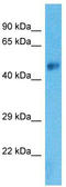 Solute Carrier Family 38 Member 8 antibody, TA332220, Origene, Western Blot image 