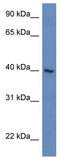 Zinc Finger Protein 821 antibody, TA345219, Origene, Western Blot image 