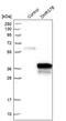 Dehydrogenase/Reductase 7B antibody, PA5-52916, Invitrogen Antibodies, Western Blot image 