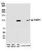 Poly(ADP-Ribose) Polymerase 1 antibody, A301-375A, Bethyl Labs, Western Blot image 