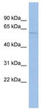 Mucolipin 3 antibody, TA338583, Origene, Western Blot image 