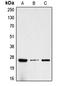 Human Chorionic gonadotrophin antibody, LS-B16073, Lifespan Biosciences, Western Blot image 