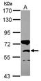 Carnitine O-palmitoyltransferase 1, brain isoform antibody, NBP2-15994, Novus Biologicals, Western Blot image 