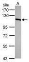 Hexokinase 3 antibody, PA5-29304, Invitrogen Antibodies, Western Blot image 