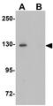 Rap Guanine Nucleotide Exchange Factor 4 antibody, GTX17165, GeneTex, Western Blot image 