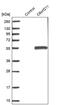 Acidic Residue Methyltransferase 1 antibody, PA5-51793, Invitrogen Antibodies, Western Blot image 