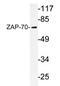 Zeta Chain Of T Cell Receptor Associated Protein Kinase 70 antibody, AP20699PU-N, Origene, Western Blot image 