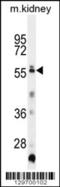 Tripartite Motif Family Like 1 antibody, 56-058, ProSci, Western Blot image 