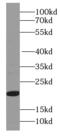 Myosin Light Chain 5 antibody, FNab05489, FineTest, Western Blot image 