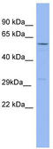 GTP-binding protein RAD antibody, TA342214, Origene, Western Blot image 