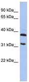 Aspartoacylase antibody, TA335131, Origene, Western Blot image 