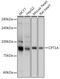 CPT I antibody, GTX53954, GeneTex, Western Blot image 
