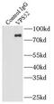 VPS52 Subunit Of GARP Complex antibody, FNab09447, FineTest, Immunoprecipitation image 