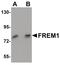 FRAS1 Related Extracellular Matrix 1 antibody, PA5-20981, Invitrogen Antibodies, Western Blot image 