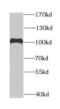 DEAD-Box Helicase 1 antibody, FNab02294, FineTest, Western Blot image 