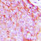 Insulin Receptor antibody, LS-C358789, Lifespan Biosciences, Immunohistochemistry paraffin image 