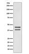 JunD Proto-Oncogene, AP-1 Transcription Factor Subunit antibody, M05609, Boster Biological Technology, Western Blot image 