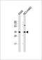 Connective tissue growth factor antibody, 63-197, ProSci, Western Blot image 