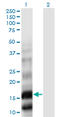 Phospholipase A2 Group X antibody, LS-C198554, Lifespan Biosciences, Western Blot image 