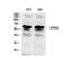 Stimulated by retinoic acid gene 8 protein homolog antibody, STJ97252, St John
