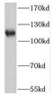 Nicotinamide Nucleotide Transhydrogenase antibody, FNab05775, FineTest, Western Blot image 