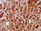 Leucine Rich Repeat Containing 45 antibody, LS-C674696, Lifespan Biosciences, Immunohistochemistry paraffin image 