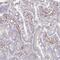 Slingshot Protein Phosphatase 2 antibody, NBP2-49245, Novus Biologicals, Immunohistochemistry frozen image 