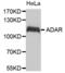 Adenosine Deaminase RNA Specific antibody, abx004531, Abbexa, Western Blot image 