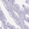 Cysteine And Glycine Rich Protein 3 antibody, HPA042581, Atlas Antibodies, Immunohistochemistry paraffin image 