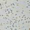 Aspartyl-TRNA Synthetase antibody, GTX33145, GeneTex, Immunohistochemistry paraffin image 