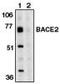 Beta-secretase 2 antibody, MBS395579, MyBioSource, Western Blot image 