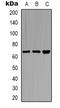 Cleavage Stimulation Factor Subunit 2 Tau Variant antibody, LS-C368693, Lifespan Biosciences, Western Blot image 