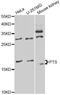 6-Pyruvoyltetrahydropterin Synthase antibody, LS-C749067, Lifespan Biosciences, Western Blot image 