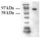 Transglutaminase 2 antibody, AM10223PU-N, Origene, Western Blot image 