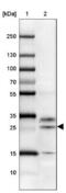 Cysteine Rich Secretory Protein 3 antibody, NBP2-33714, Novus Biologicals, Western Blot image 