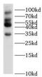 Sarcolemma Associated Protein antibody, FNab07986, FineTest, Western Blot image 