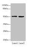 Zinc Finger And BTB Domain Containing 32 antibody, CSB-PA897538LA01HU, Cusabio, Western Blot image 