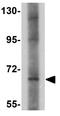 Leucine Zipper Tumor Suppressor Family Member 3 antibody, GTX85249, GeneTex, Western Blot image 