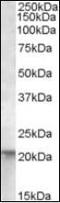 Ras antibody, orb88243, Biorbyt, Western Blot image 