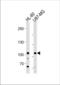 MORC Family CW-Type Zinc Finger 3 antibody, TA325143, Origene, Western Blot image 