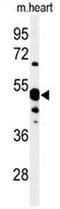 5'-Nucleotidase, Cytosolic IA antibody, AP50003PU-N, Origene, Western Blot image 