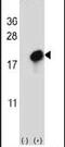 CKLF Like MARVEL Transmembrane Domain Containing 7 antibody, PA5-24944, Invitrogen Antibodies, Western Blot image 