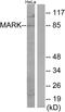Microtubule Affinity Regulating Kinase 1 antibody, LS-C119293, Lifespan Biosciences, Western Blot image 