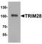 Tripartite Motif Containing 28 antibody, TA319808, Origene, Western Blot image 