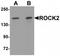 Rho Associated Coiled-Coil Containing Protein Kinase 2 antibody, TA319779, Origene, Western Blot image 
