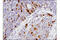 Aurora Kinase A antibody, 91590S, Cell Signaling Technology, Immunohistochemistry paraffin image 