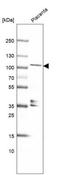 KN Motif And Ankyrin Repeat Domains 4 antibody, NBP1-89079, Novus Biologicals, Western Blot image 